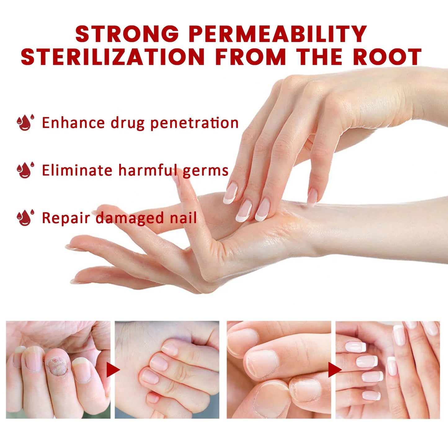 Anti Fungus Relief Oil Treatment Inflammation Nail