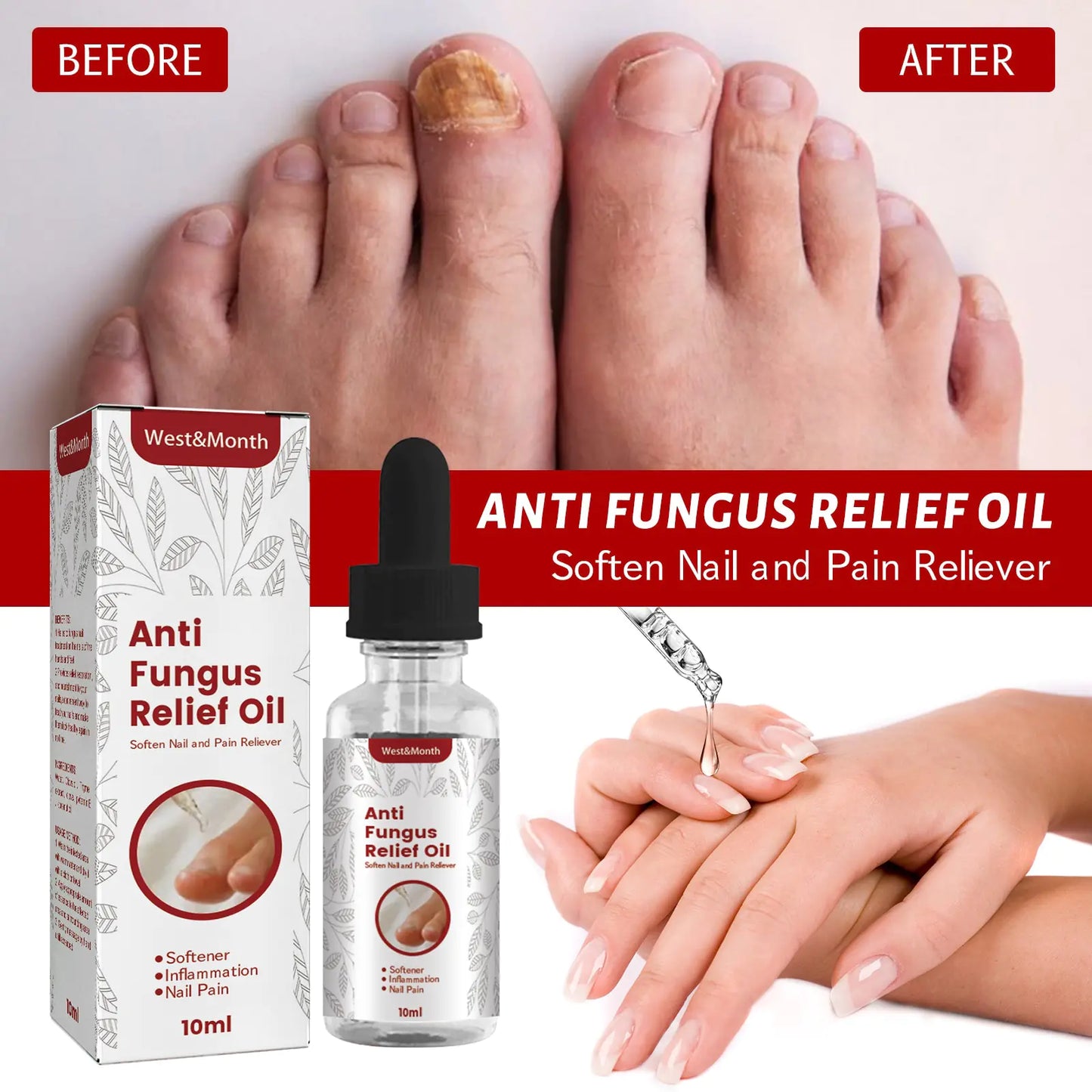 Anti Fungus Relief Oil Treatment Inflammation Nail